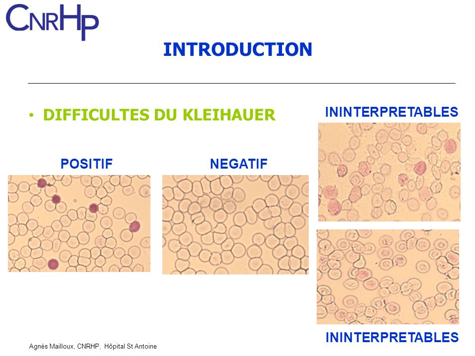 test de kleihauer positif