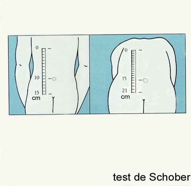 test de schober