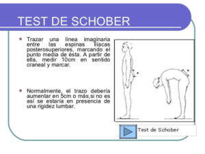 test de schober