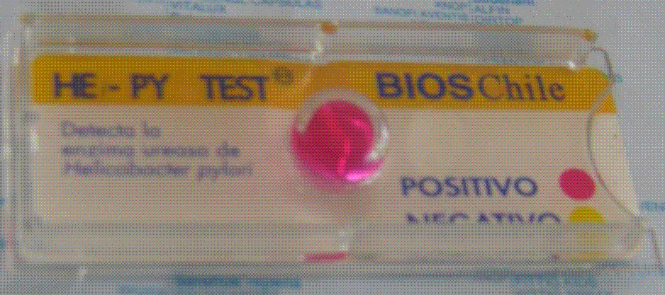 test de ureasa positivo