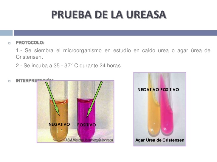 test de ureasa positivo