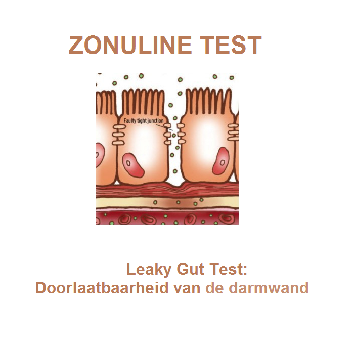 test de zonuline
